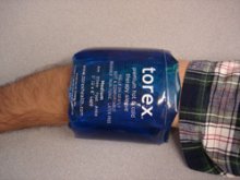 MSD Torex Medium Sleeve from PhysioOnline.ie - Physiotherapy Ireland